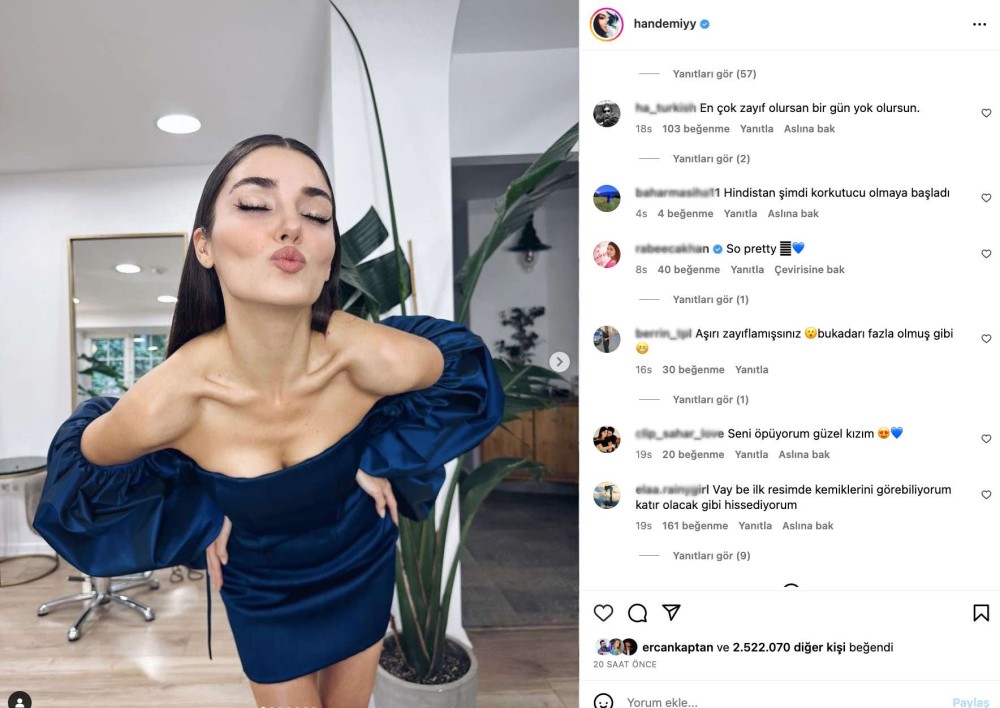 hande ercel in son hali gundem oldu cok zayiflamissin kemiklerini sayabiliyorum